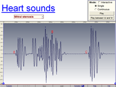 Heart sounds 1